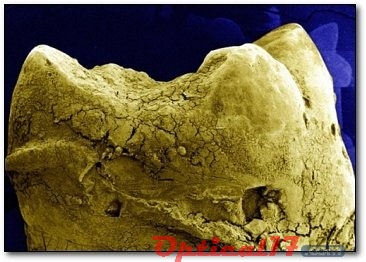 顯微鏡下人的牙齒