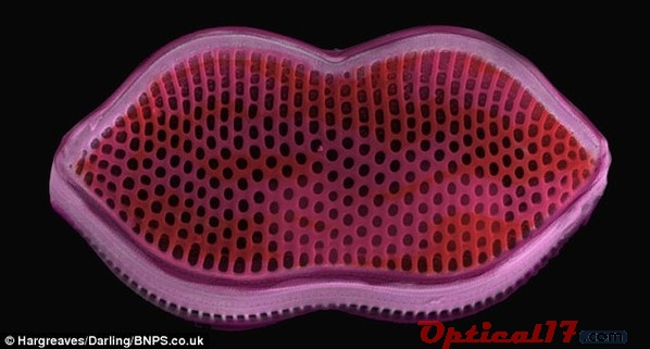 這張拉長且彎曲的細胞圖片