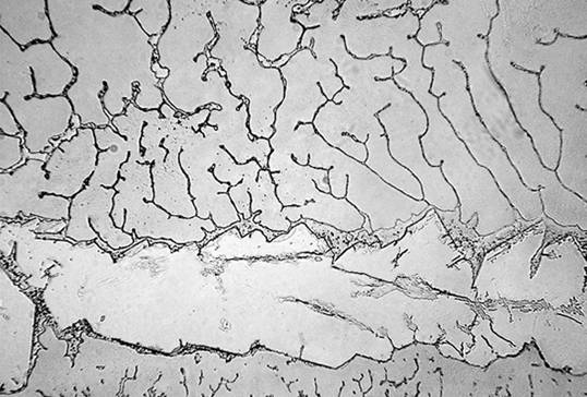 學生顯微鏡下的微觀大世界——眼淚