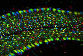 第四屆奧林巴斯顯微鏡全國(guó)顯微圖像大賽獲獎(jiǎng)選手訪談