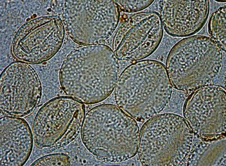 顯微鏡探索微觀世界的精彩：美麗的飛絮：