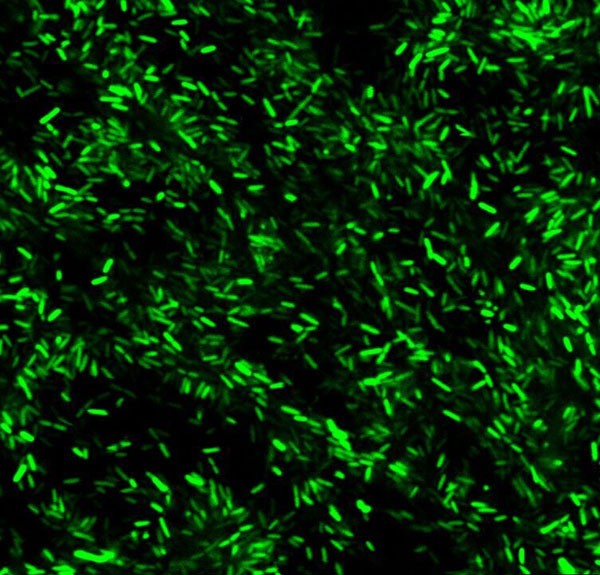 激光共聚焦顯微鏡 “東北大米”