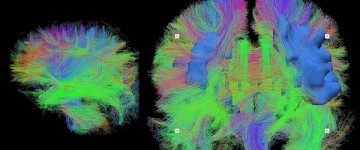 科學(xué)家?guī)闵钊肓私怙@微鏡下的大腦組織