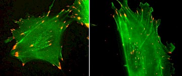 蛋白質(zhì)的沉默密碼影響細(xì)胞的運(yùn)動方式