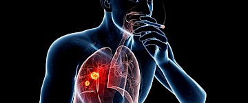 DNA突變研究揭示了為什么大多數(shù)吸煙者從未患過肺癌