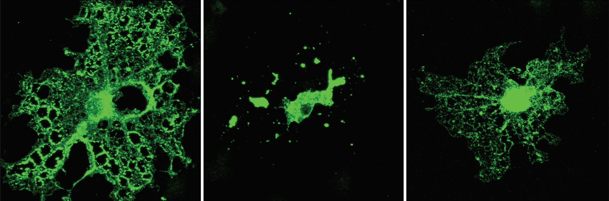 缺乏 TDP-43 的少突膠質(zhì)細(xì)胞產(chǎn)生較少的髓磷脂